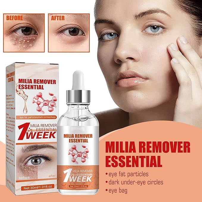Smooth Milia Remover Serum (30ml) – Jambee